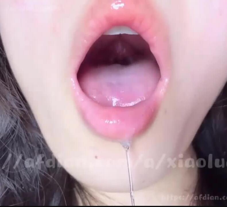 小鹿大困包 喉咙